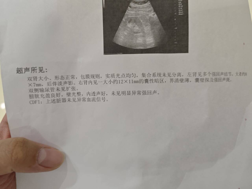 ����ʯ����