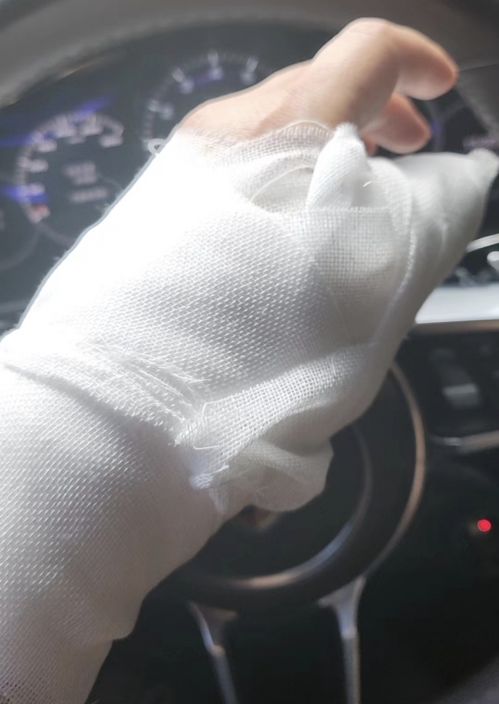 被门夹到的白痴