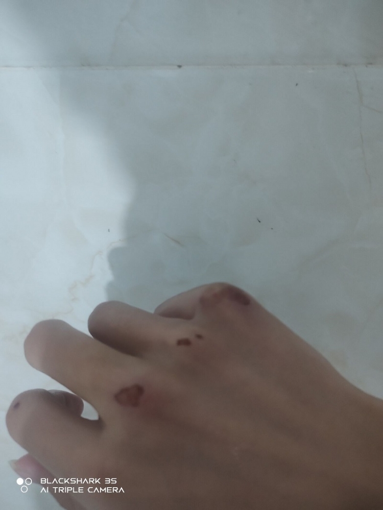 右手还好点