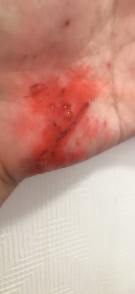 我的神之力啊！