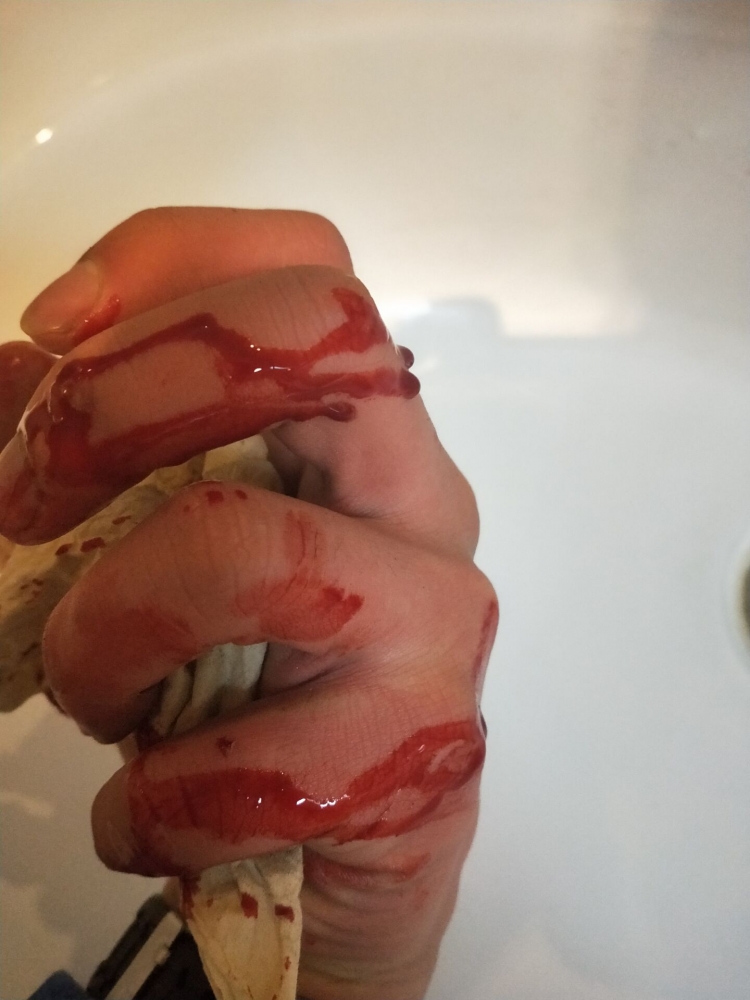 你们觉得窝疼吗？