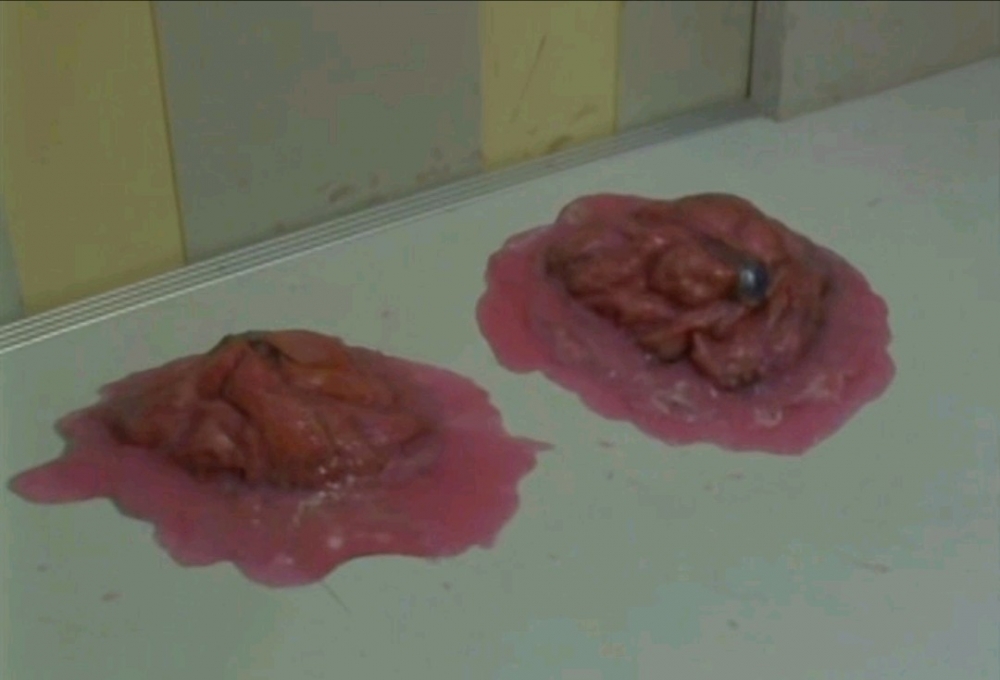 童年阴影——比佐摩