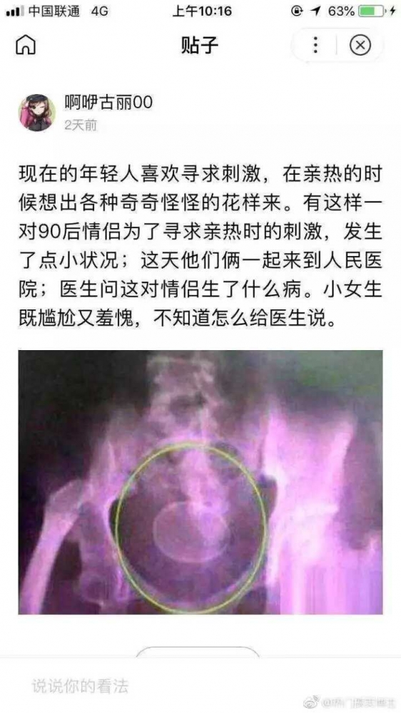 诶？？（呆萌）