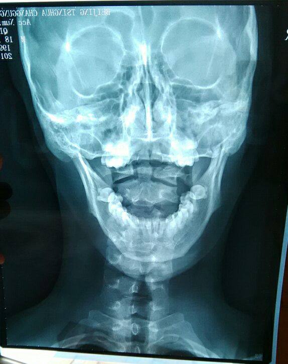 骷髅微笑（沙之歌提供