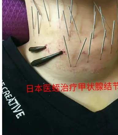 其实现在也在用