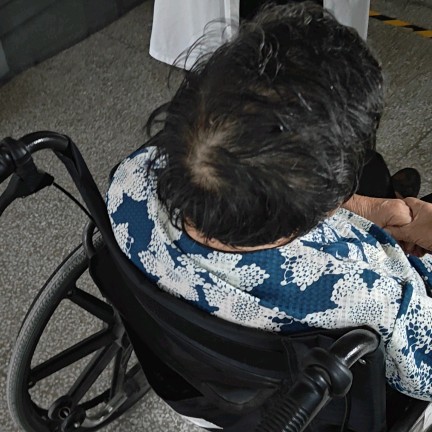 秃顶会不会遗传啊