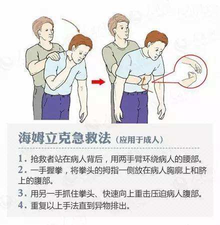 海姆立克急救法