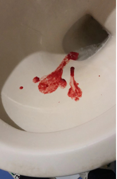 疼死了