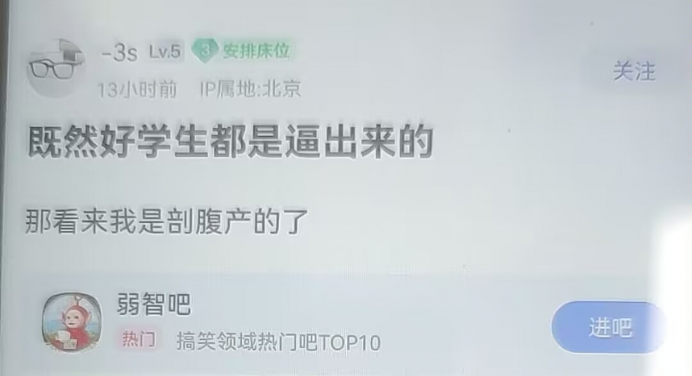 剖腹产