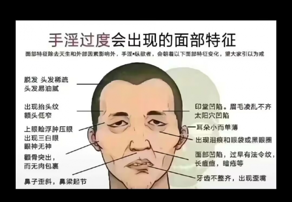 引以为戒（