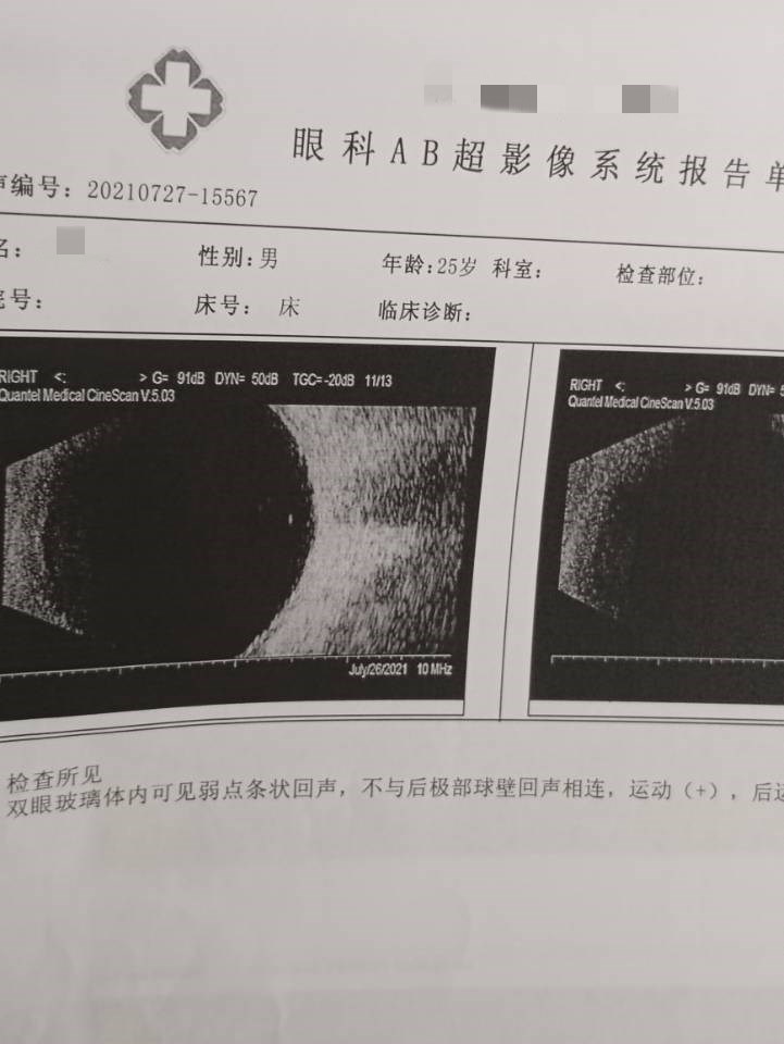 检查报告2