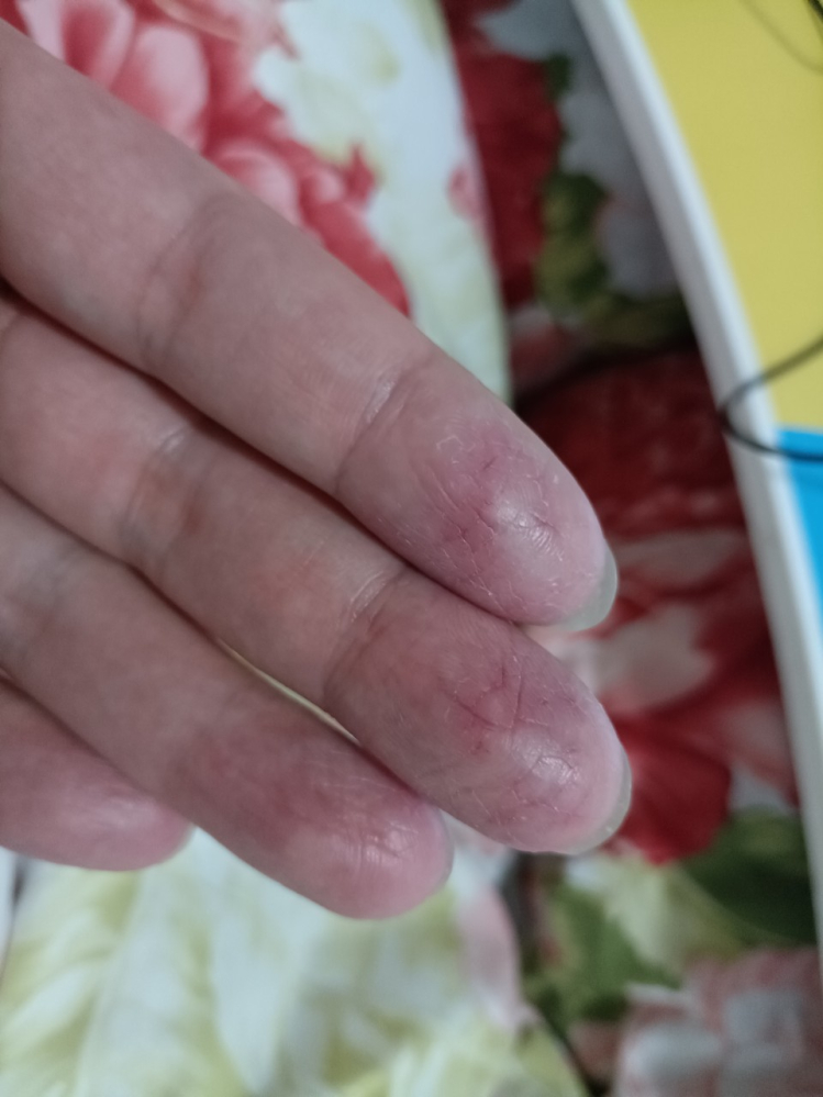 过于娇嫩的自己……