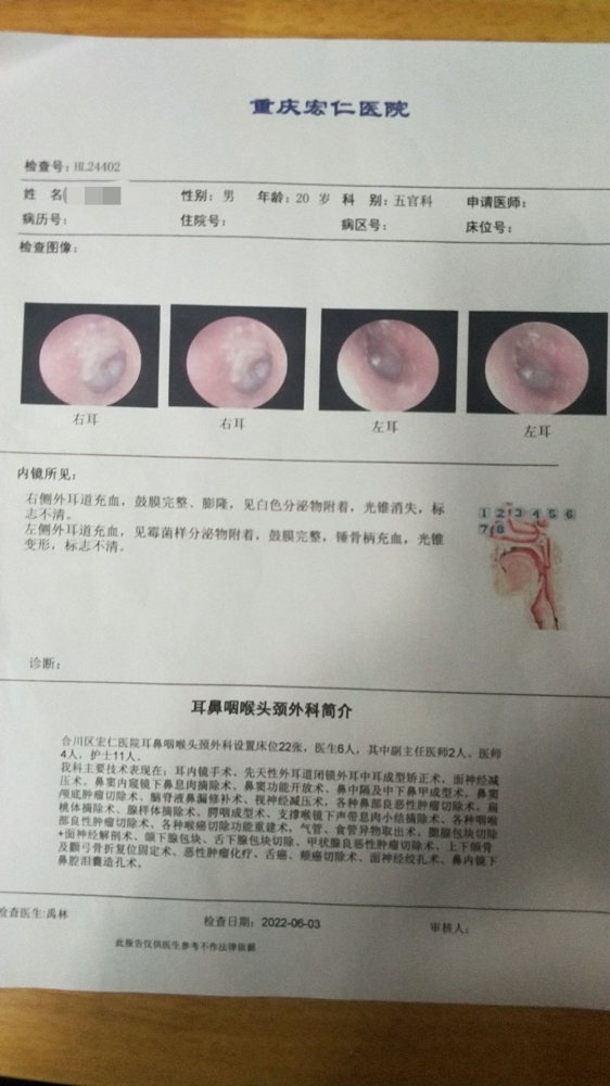 中耳炎检查报告